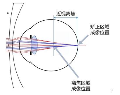 給眼睛放個假！少霞與愛爾眼科近視防控專家邀您共賞閩南文化